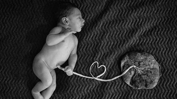 Lotus Birth: Nurturing Life's Natural Bloom. Cover